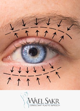 شد الجفون image