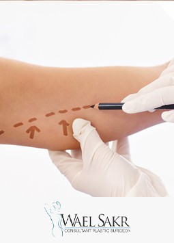 شد الذراعين image